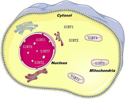 Distinctive Roles of Sirtuins on Diabetes, Protective or Detrimental?